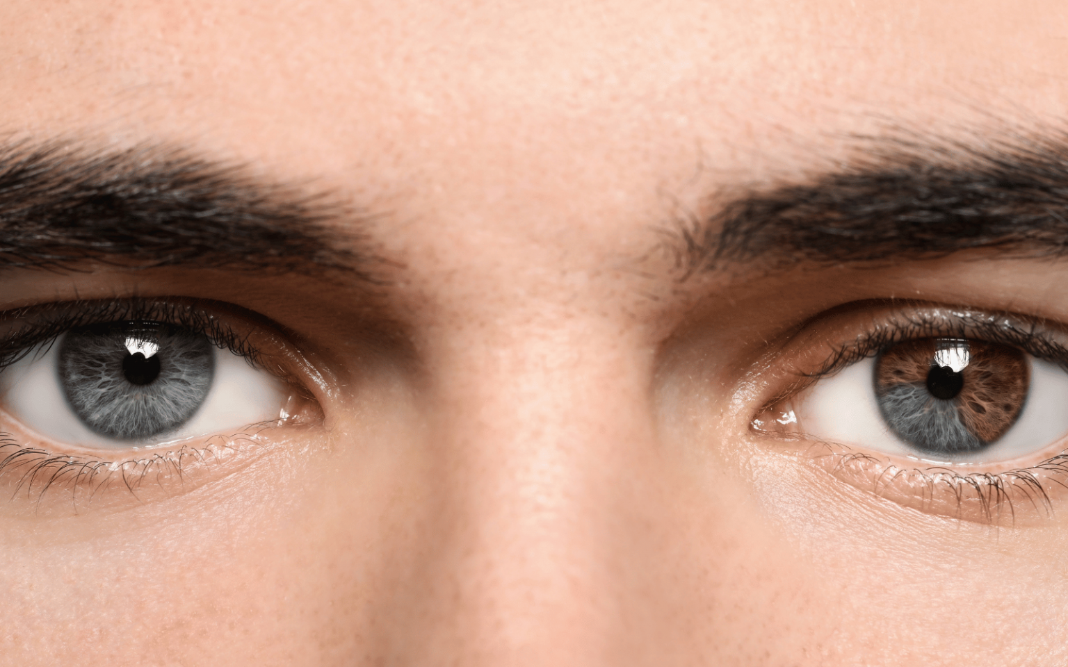 A man with blue and brown eyes